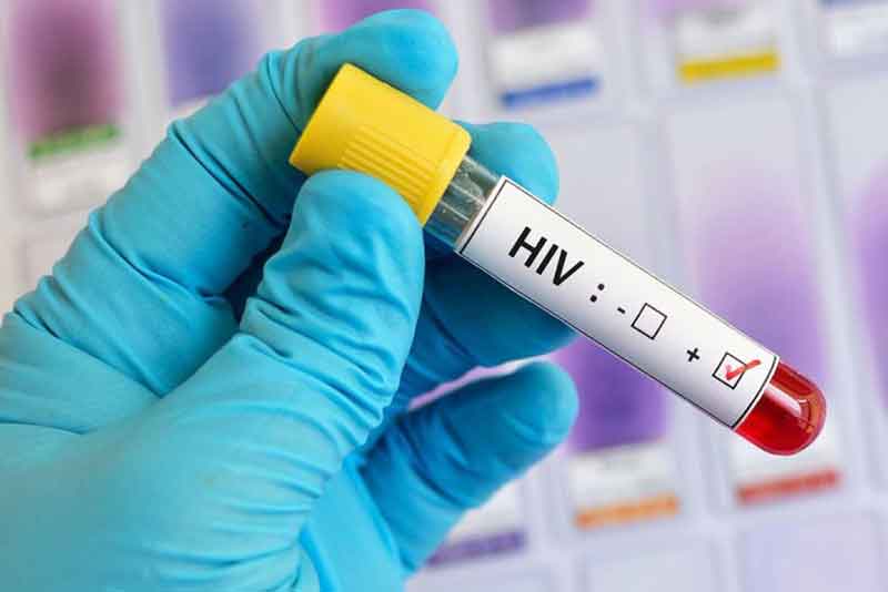 Жители Новотроицка смогут сдать анализы на ВИЧ в мобильных пунктах