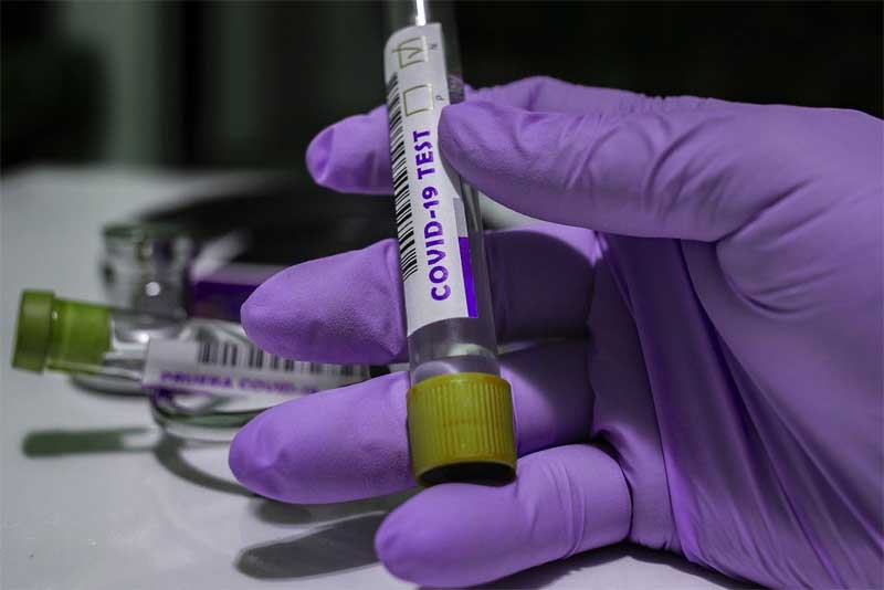 За сутки в Оренбургской области выявлено 3253 заболевших коронавирусом