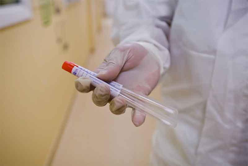 В Оренбуржье впервые более 400 человек заболели коронавирусом за сутки