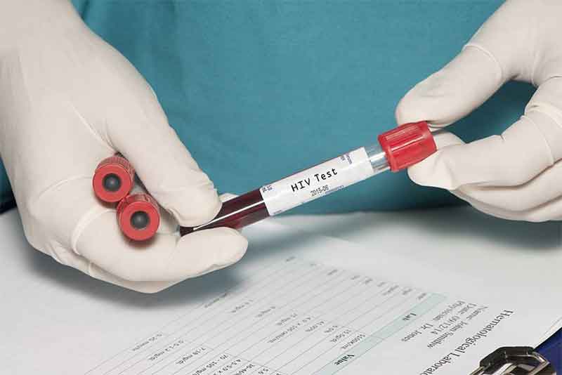 Тест на ВИЧ-инфекцию в Оренбуржье можно будет сдать без очереди