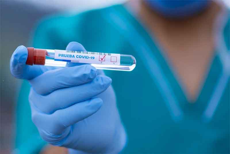 Оренбургские медики выявили 48 новых случаев заболевания COVID-19